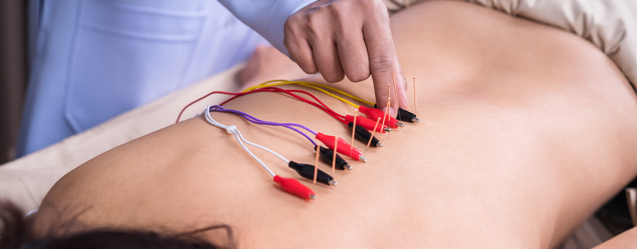 Electrical Stimulation Florence, SC & Palmyra, MO - Priority Physical  Therapy