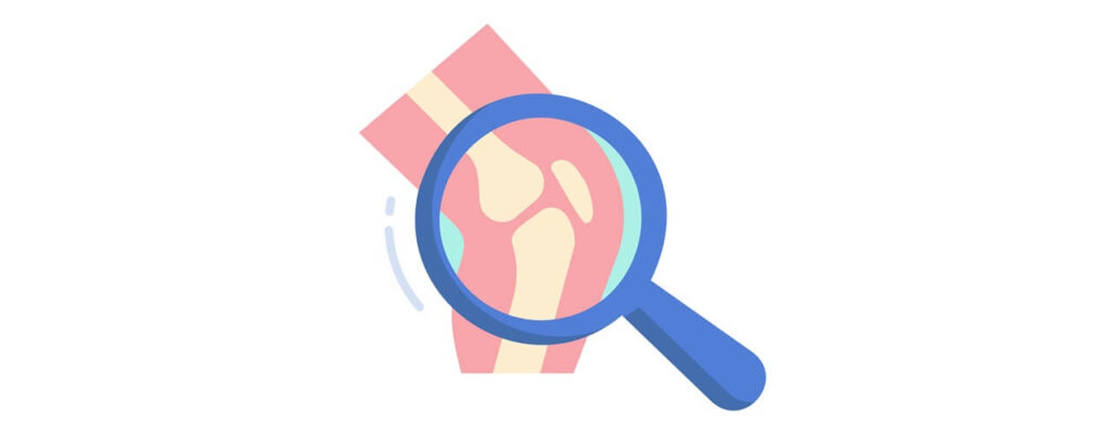 Understanding_Knee_Pain_Causes_Key_Insights_for_Effective_Treatment.